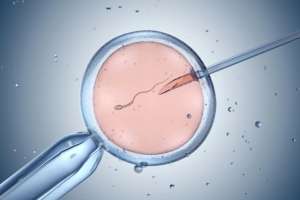IN VITRO FERTILIZATION